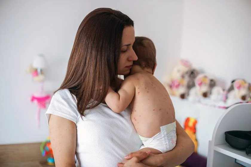 Maman réconfortant son bébé malade, illustrant le besoin de repos pendant la roséole