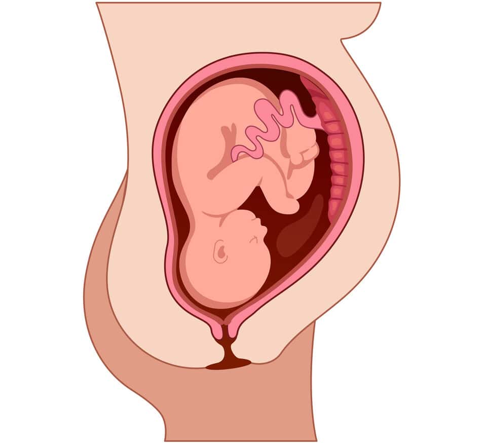 Illustration médicale d'un fœtus dans l'utérus pendant la grossesse avec cordon ombilical et placenta
