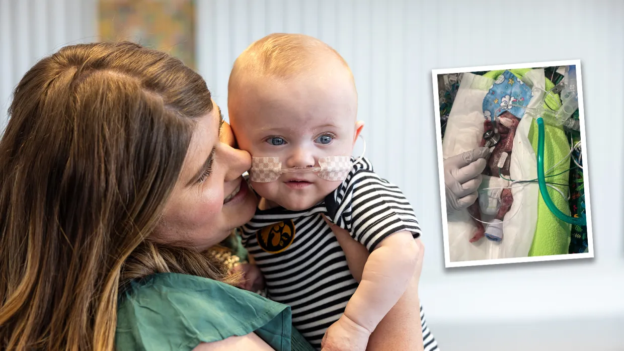Nash Keen, le bébé le plus prématuré du monde, souriant dans les bras de sa mère