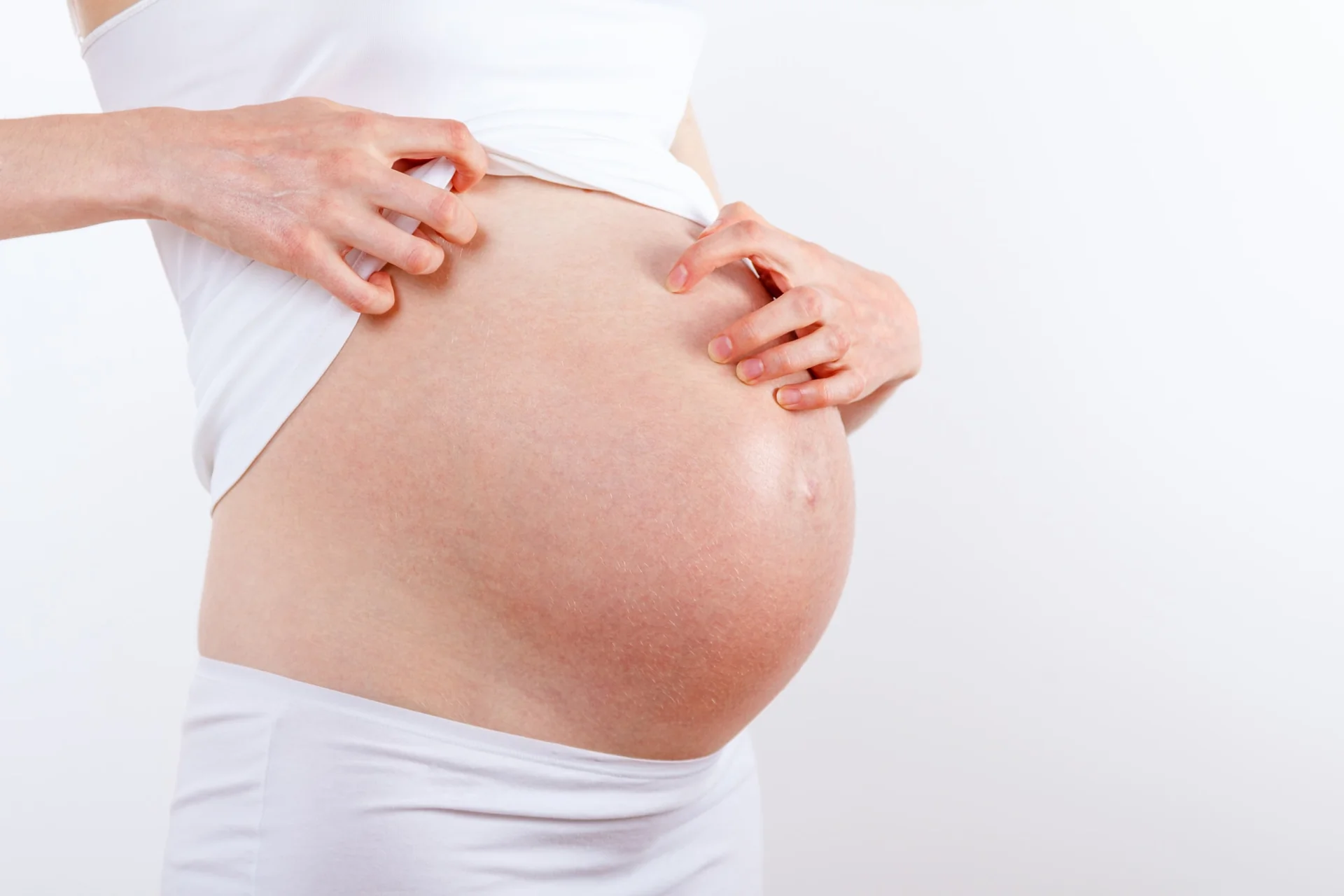 Le syndrome PUPPP : Tout savoir sur cette éruption cutanée de fin de grossesse - Grossesse & Accouchement