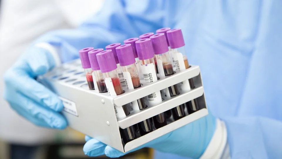 Tubes de prélèvement sanguin pour le dépistage de la toxoplasmose grossesse.