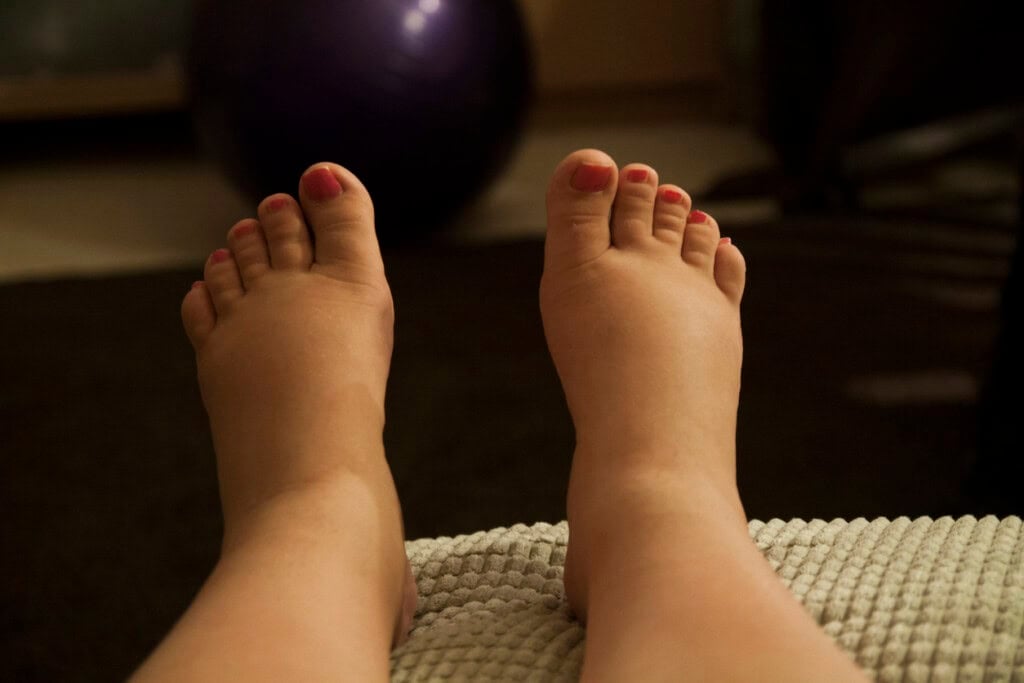 Pieds gonflés d'une femme enceinte posés sur un tapis